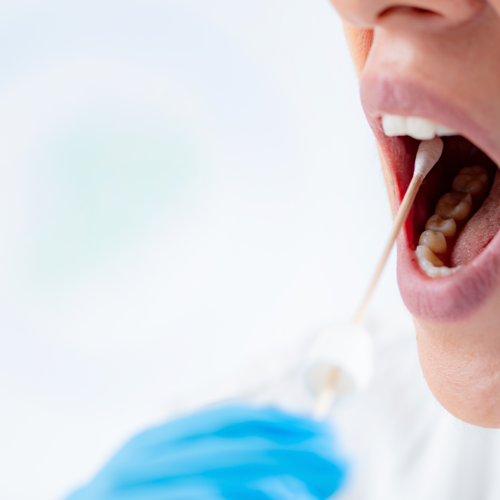 Halitosis causas, prevención y soluciones para un aliento fresco