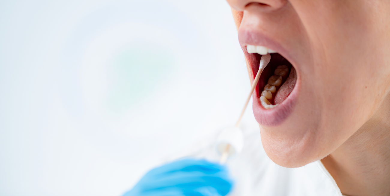 Halitosis causas, prevención y soluciones para un aliento fresco