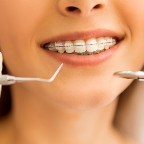 Ortodoncia: todo lo que necesitas saber para una sonrisa alineada